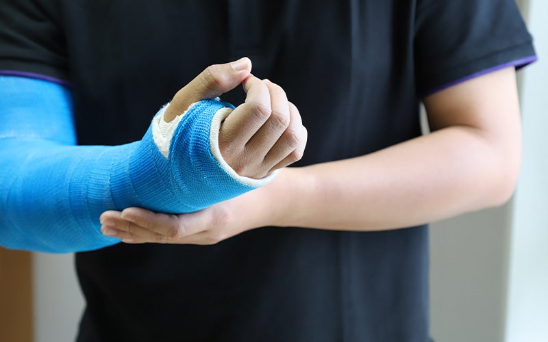 Person wearing a dark shirt with a bright blue cast on their left arm and hand, fingers visible.
